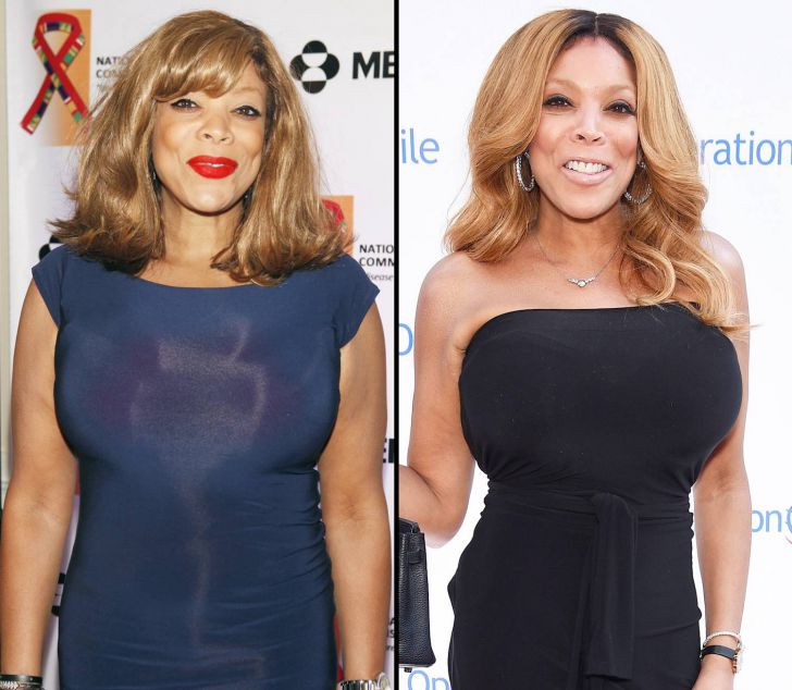 23 Celebrities Before And After Weight Loss_6