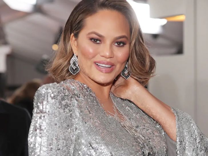 8 Famous Celebs Who Never Mind Flaunting Their Flaws_1